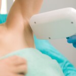 процесс лазерной эпиляции